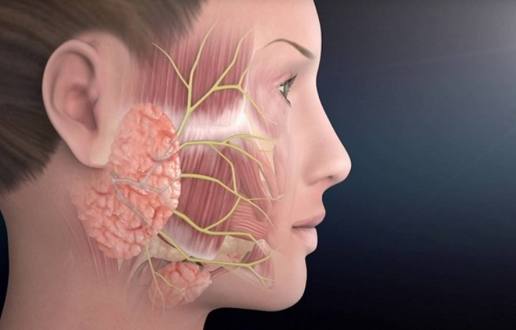 Điện mãng châm điều trị liệt dây thần kinh ngoại biên